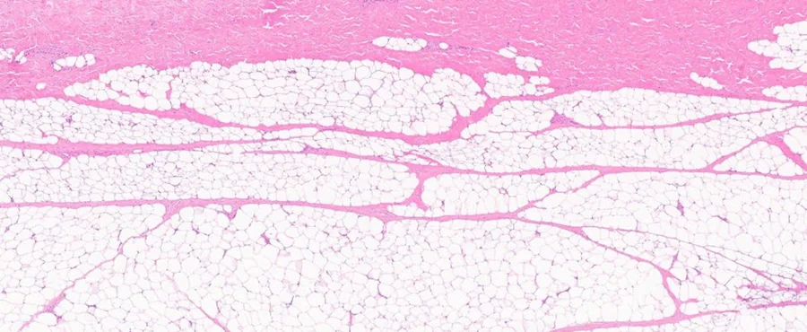 Figure 4 from the study: H&E stained section of untreated ex vivo porcine skin, dermal fibrous tissue intact
